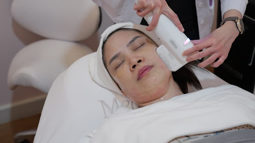 What to Do After Morpheus8 Treatment
