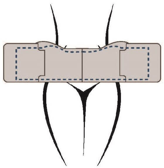 BTL Vanquish ME device illustration
