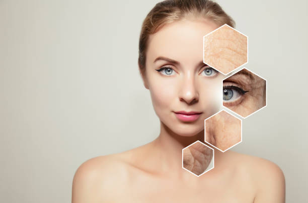 Anti-Aging