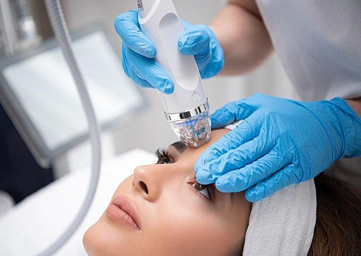 RF microneedling skin treatment being performed at Revive Atlanta MD